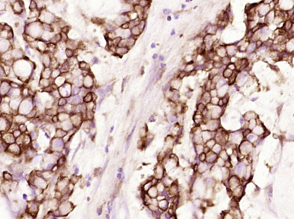 Cytokeratin 19 Antibody in Immunohistochemistry (Paraffin) (IHC (P))