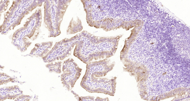 Cytokeratin 19 Antibody in Immunohistochemistry (Paraffin) (IHC (P))