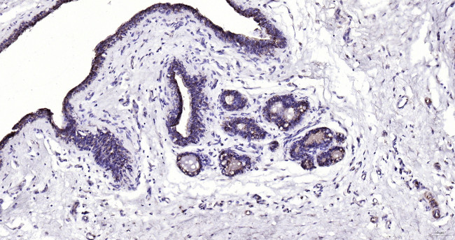 Cytokeratin 19 Antibody in Immunohistochemistry (Paraffin) (IHC (P))