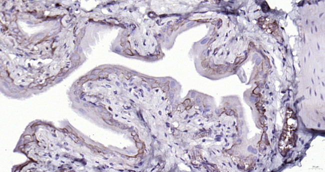 Cytokeratin 19 Antibody in Immunohistochemistry (Paraffin) (IHC (P))