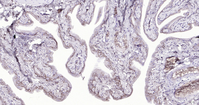 Cytokeratin 19 Antibody in Immunohistochemistry (Paraffin) (IHC (P))