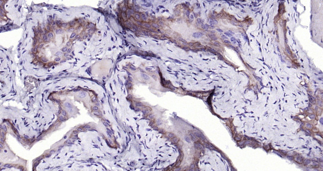 Cytokeratin 19 Antibody in Immunohistochemistry (Paraffin) (IHC (P))