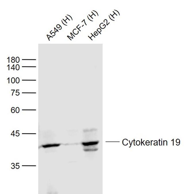 Cytokeratin 19 Antibody in Western Blot (WB)