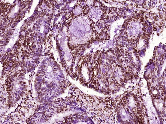 Histone H3 (Di methyl K79) Antibody in Immunohistochemistry (Paraffin) (IHC (P))