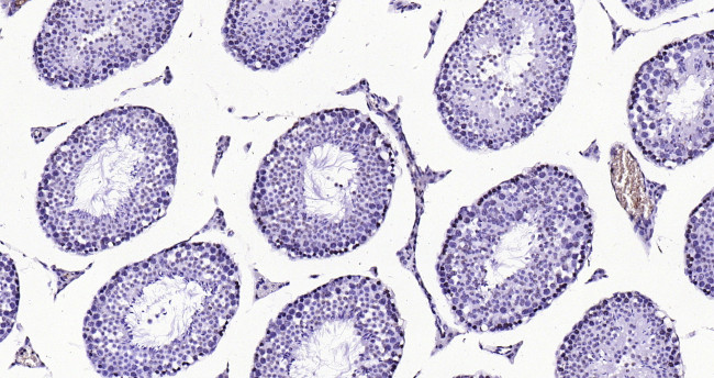 Histone H3 (tri methyl K79) Antibody in Immunohistochemistry (Paraffin) (IHC (P))