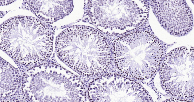 Histone H3 (tri methyl K79) Antibody in Immunohistochemistry (Paraffin) (IHC (P))