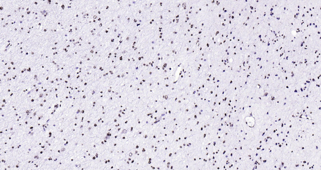 Histone H3 (tri methyl K79) Antibody in Immunohistochemistry (Paraffin) (IHC (P))