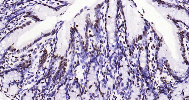 Histone H3 (tri methyl K79) Antibody in Immunohistochemistry (Paraffin) (IHC (P))