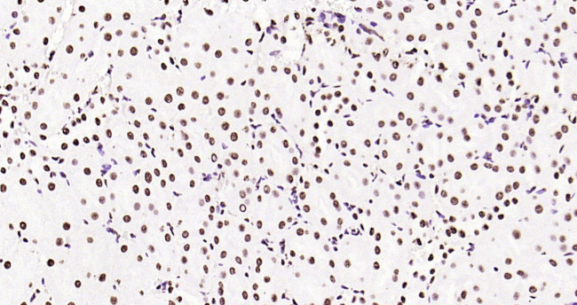 Histone H3 (tri methyl K79) Antibody in Immunohistochemistry (Paraffin) (IHC (P))