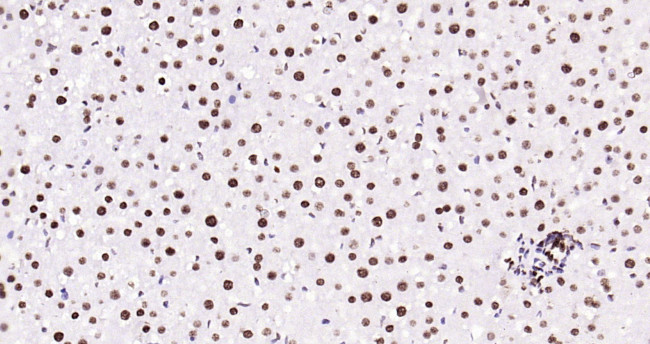 Histone H3 (tri methyl K79) Antibody in Immunohistochemistry (Paraffin) (IHC (P))