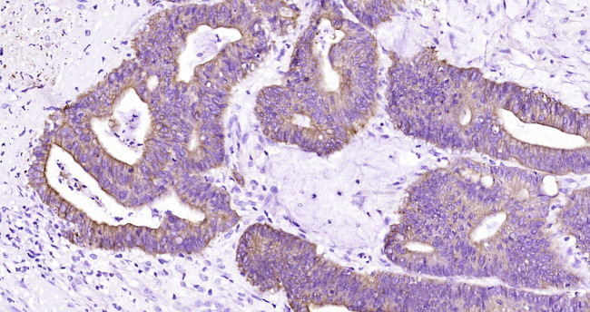 CK18 Antibody in Immunohistochemistry (Paraffin) (IHC (P))