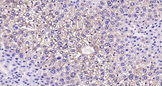 CK18 Antibody in Immunohistochemistry (Paraffin) (IHC (P))