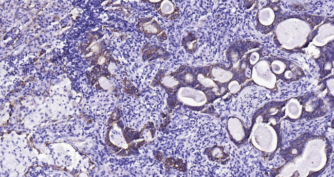 CK18 Antibody in Immunohistochemistry (Paraffin) (IHC (P))