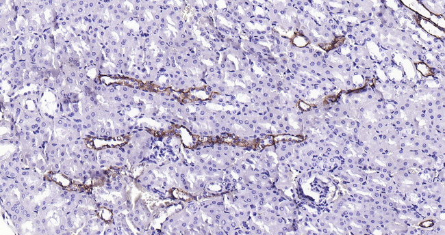 CK18 Antibody in Immunohistochemistry (Paraffin) (IHC (P))