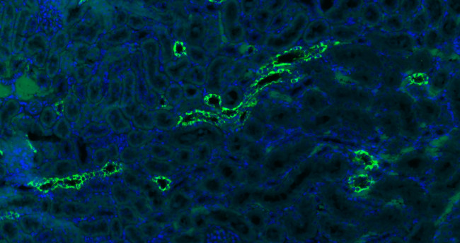 CK18 Antibody in Immunohistochemistry (Paraffin) (IHC (P))