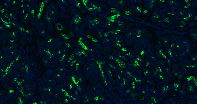 CK18 Antibody in Immunohistochemistry (Paraffin) (IHC (P))