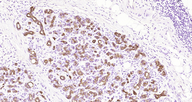 CK18 Antibody in Immunohistochemistry (Paraffin) (IHC (P))