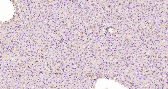 CK18 Antibody in Immunohistochemistry (Paraffin) (IHC (P))