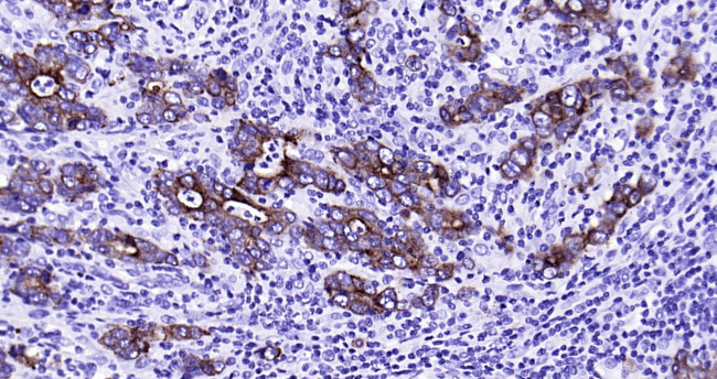 CK18 Antibody in Immunohistochemistry (Paraffin) (IHC (P))