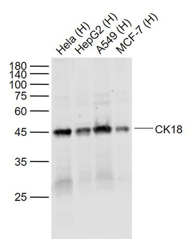 CK18 Antibody in Western Blot (WB)