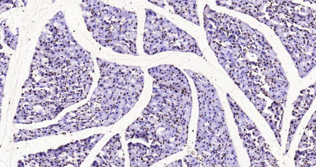 Histone H3 (di methyl K27) Antibody in Immunohistochemistry (Paraffin) (IHC (P))