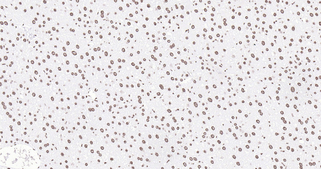 Histone H3 (di methyl K27) Antibody in Immunohistochemistry (Paraffin) (IHC (P))