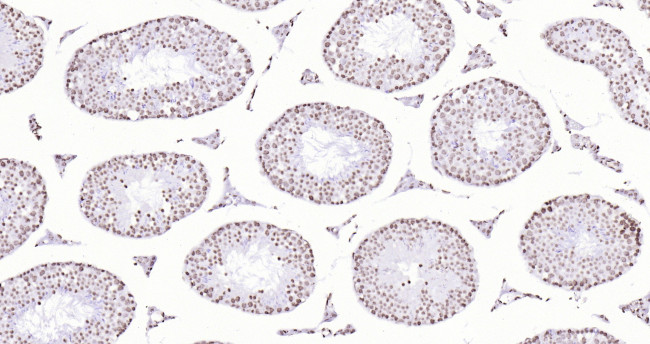 Histone H3 (di methyl K27) Antibody in Immunohistochemistry (Paraffin) (IHC (P))