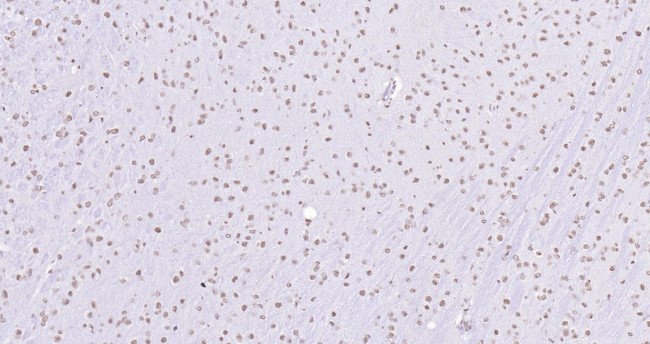 Histone H3 (di methyl K27) Antibody in Immunohistochemistry (Paraffin) (IHC (P))