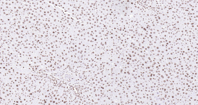 Histone H3 (di methyl K27) Antibody in Immunohistochemistry (Paraffin) (IHC (P))