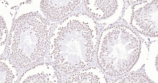 Histone H3 (di methyl K27) Antibody in Immunohistochemistry (Paraffin) (IHC (P))