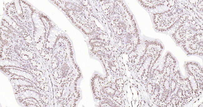 Histone H3 (di methyl K27) Antibody in Immunohistochemistry (Paraffin) (IHC (P))