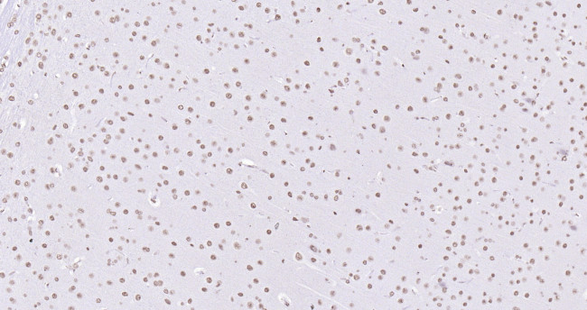 Histone H3 (di methyl K27) Antibody in Immunohistochemistry (Paraffin) (IHC (P))