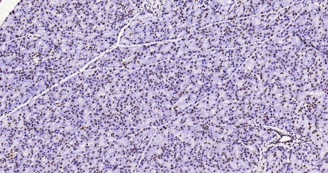 Histone H3 (di methyl K27) Antibody in Immunohistochemistry (Paraffin) (IHC (P))