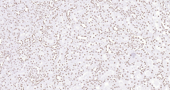 Histone H3 (di methyl K27) Antibody in Immunohistochemistry (Paraffin) (IHC (P))