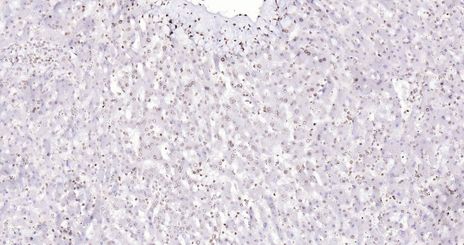 Histone H3 (di methyl K27) Antibody in Immunohistochemistry (Paraffin) (IHC (P))