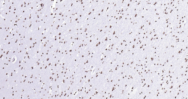 Histone H3 (di methyl K27) Antibody in Immunohistochemistry (Paraffin) (IHC (P))