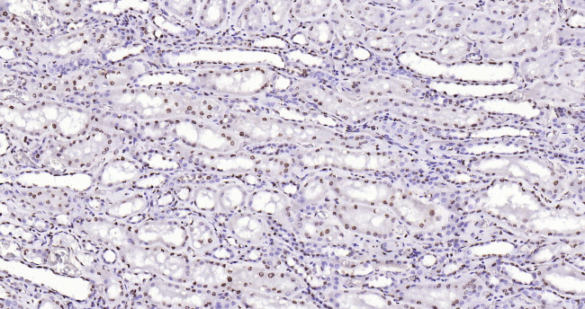 Histone H3 (di methyl K27) Antibody in Immunohistochemistry (Paraffin) (IHC (P))