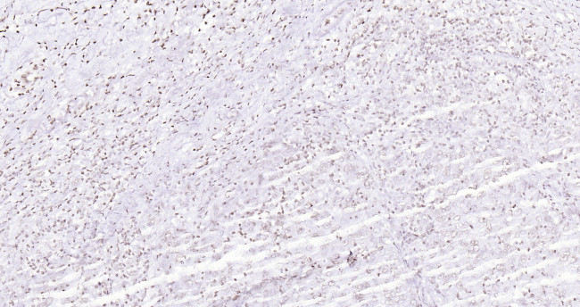 Histone H3 (di methyl K27) Antibody in Immunohistochemistry (Paraffin) (IHC (P))