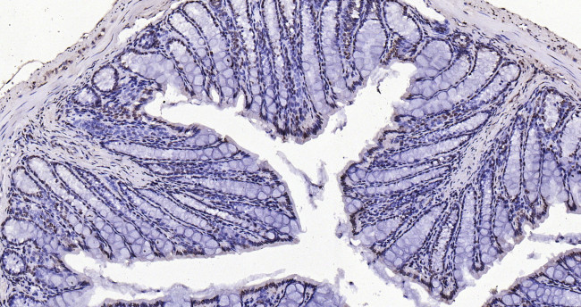 Histone H3 (di methyl K27) Antibody in Immunohistochemistry (Paraffin) (IHC (P))