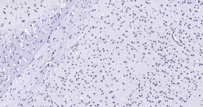 Histone H3 (di methyl K27) Antibody in Immunohistochemistry (Paraffin) (IHC (P))