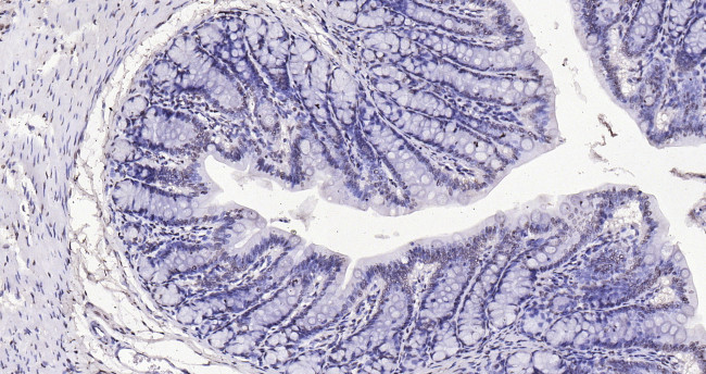 Histone H3 (di methyl K27) Antibody in Immunohistochemistry (Paraffin) (IHC (P))