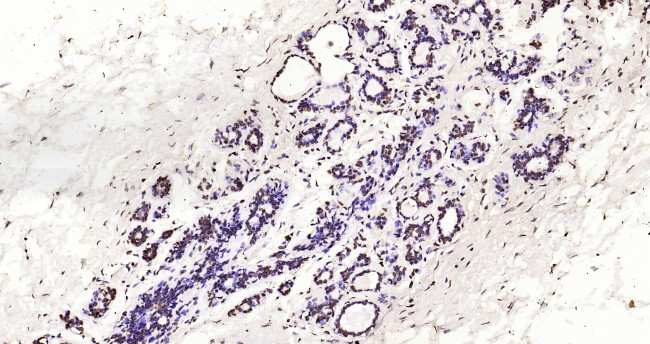 Histone H3 (di methyl K27) Antibody in Immunohistochemistry (Paraffin) (IHC (P))