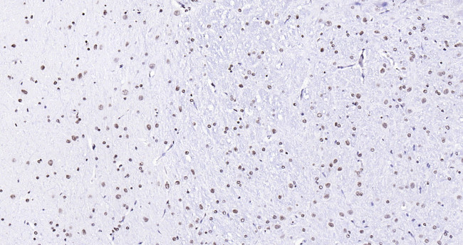 Histone H3 (di methyl K27) Antibody in Immunohistochemistry (Paraffin) (IHC (P))