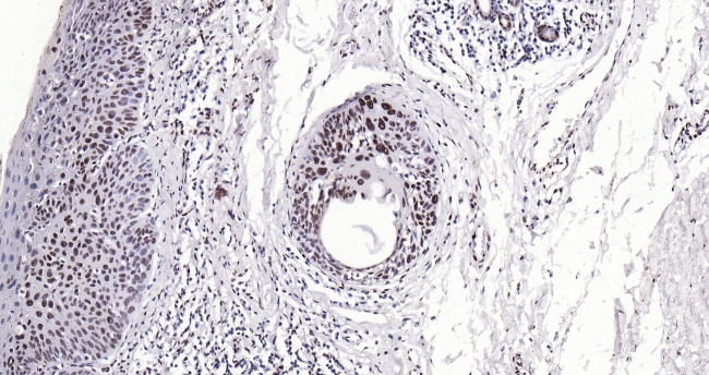 Histone H3 (di methyl K27) Antibody in Immunohistochemistry (Paraffin) (IHC (P))