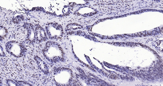 Histone H3 (di methyl K27) Antibody in Immunohistochemistry (Paraffin) (IHC (P))