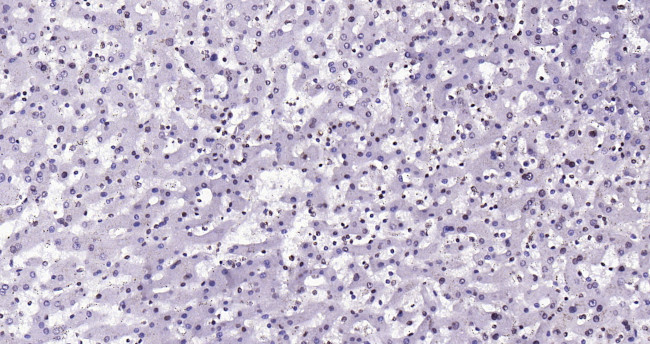 Histone H3 (di methyl K27) Antibody in Immunohistochemistry (Paraffin) (IHC (P))