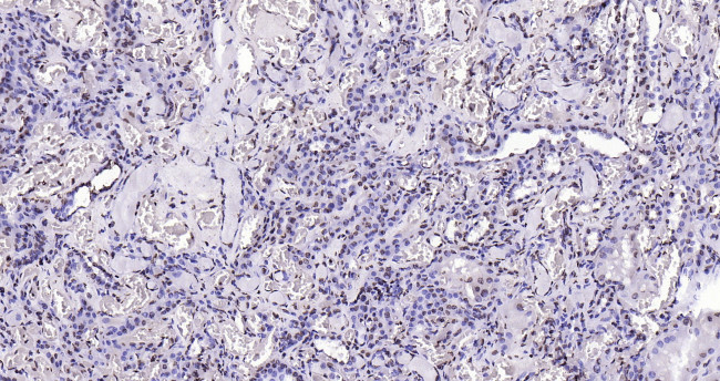 Histone H3 (di methyl K27) Antibody in Immunohistochemistry (Paraffin) (IHC (P))