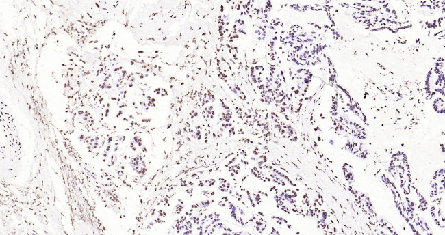 Histone H3 (di methyl K27) Antibody in Immunohistochemistry (Paraffin) (IHC (P))