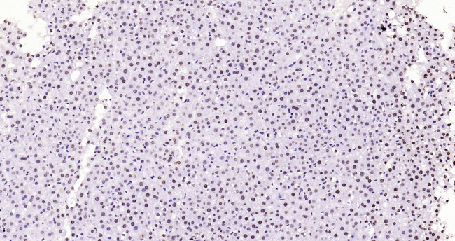 Histone H3 (di methyl K27) Antibody in Immunohistochemistry (Paraffin) (IHC (P))