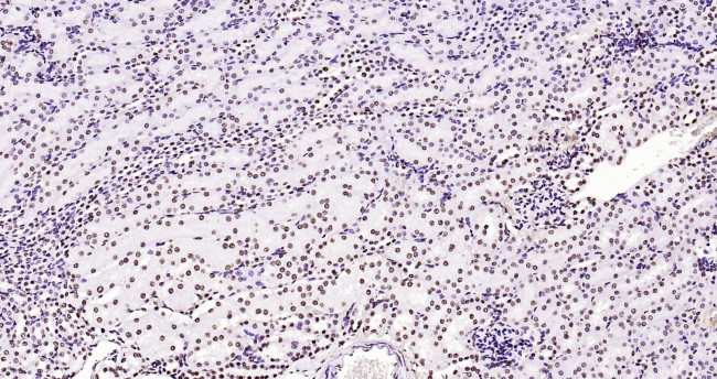 Histone H3 (di methyl K27) Antibody in Immunohistochemistry (Paraffin) (IHC (P))